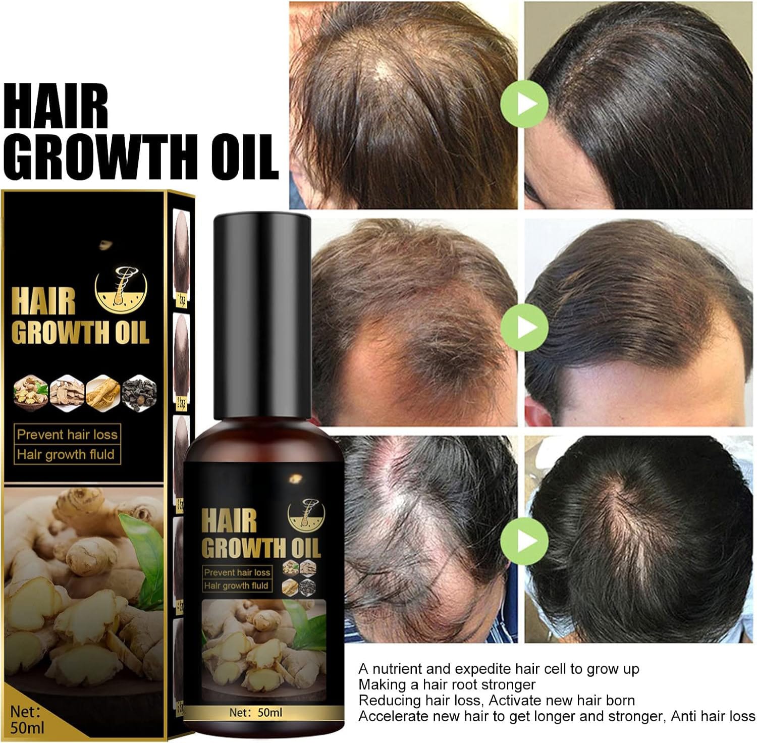 Hair Growth Oil 100ml Each Pack Of 2
