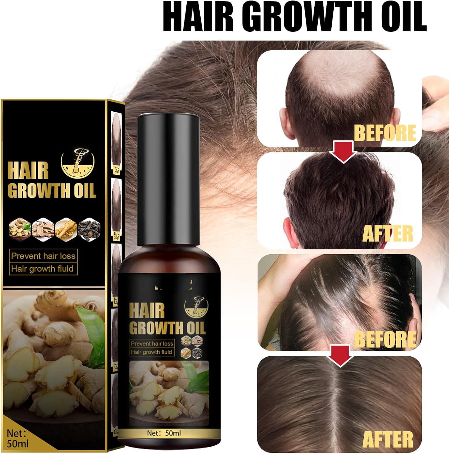Hair Growth Oil 100ml Each Pack Of 2