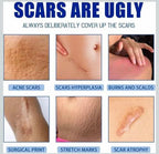Scar Removal Cream 100g Each Pack Of 2
